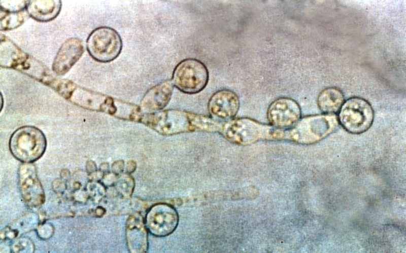 Shape-shifting Candida albicans: yeast, fungus, or both?